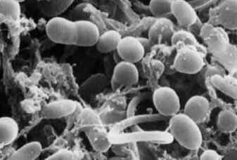 Bacteremia