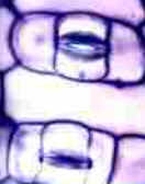 Epiderme