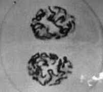Meiose Meiose