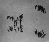 Meiose Meiose
