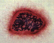 Mitose