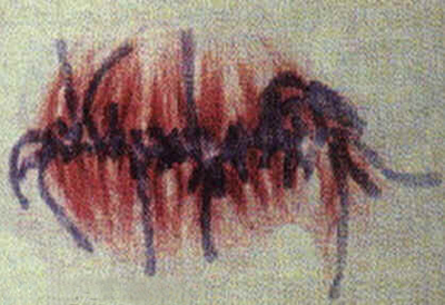 Mitose