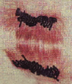 Mitose