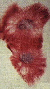 Mitose
