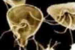 Parasitoses