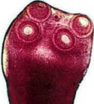 Parasitoses