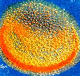 Parasitoses