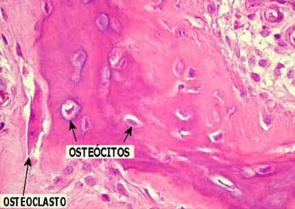 Osteoclasto