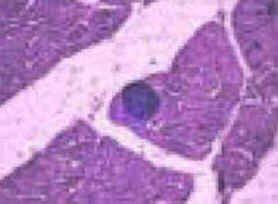 Parasitoses Parasitoses