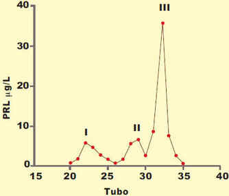 Prolactina