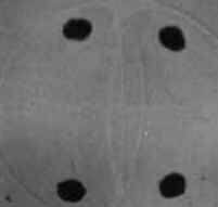 Meiose Meiose