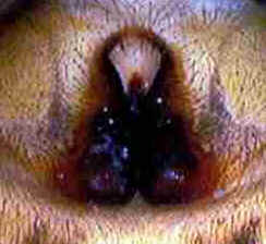 Anatomia das Aranhas