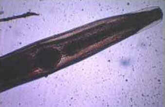 Classe Nematoda
