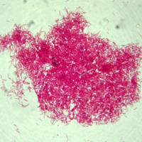 Gardnerella vaginalis