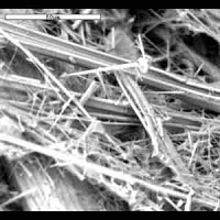 Asbestose