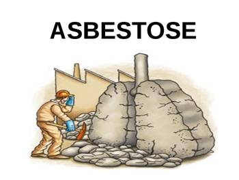 Asbestose Asbestose