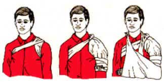 Fraturas
