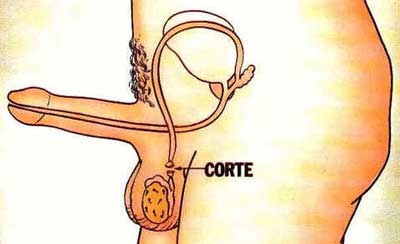 Métodos Anticoncepcionais Métodos Anticoncepcionais