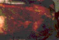 Queimaduras