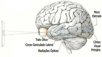 Retinopatia