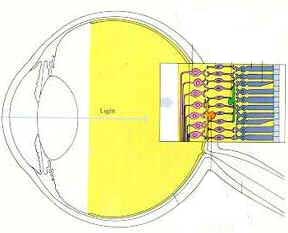 Retinopatia Retinopatia
