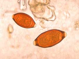 Verminoses Verminoses