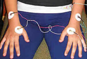 Acupuntura