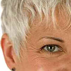 Botox