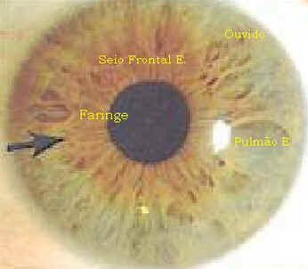 Iridologia