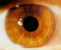 Iridologia