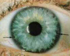 Iridologia