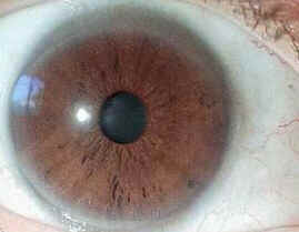 Iridologia