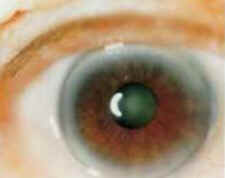 Iridologia