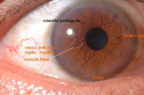 Iridologia