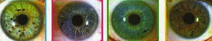 Iridologia
