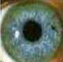Iridologia
