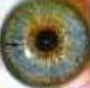 Iridologia