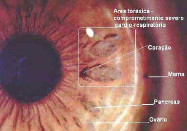 Iridologia