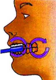 Dentes Dentes