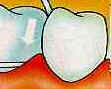Dentes Dentes
