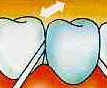 Dentes Dentes