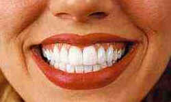 Dentes Dentes