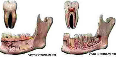 Dentes Dentes