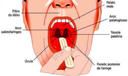 Boca Boca