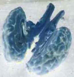 Hemisférios Cerebrais