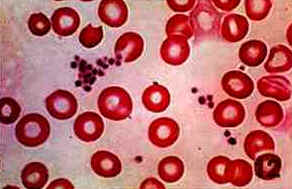 Sangue Sangue
