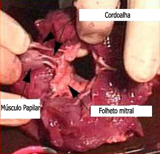 Válvulas Cardíacas Válvulas Cardíacas
