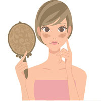 Melasma