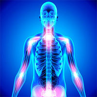 Fibromialgia