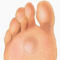 Calos